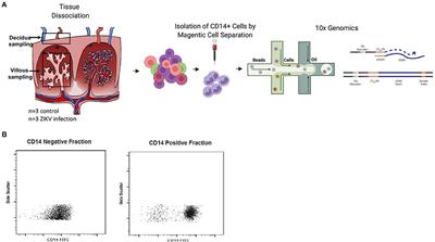 Differential Type 1 IFN Gene Expression in CD14+ Placenta Cells Elicited by Zika Virus Infection During Pregnancy